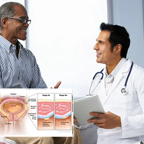 Understanding the Basics of Penile Implants with  Greater Long Beach Surgery Center

